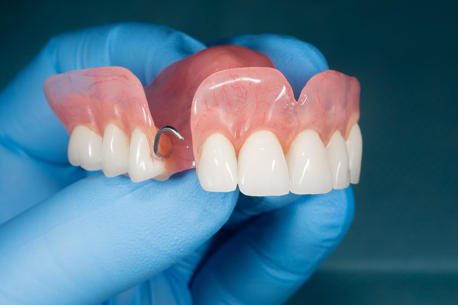 Prótesis dentales removibles SnaponSmile en Teo